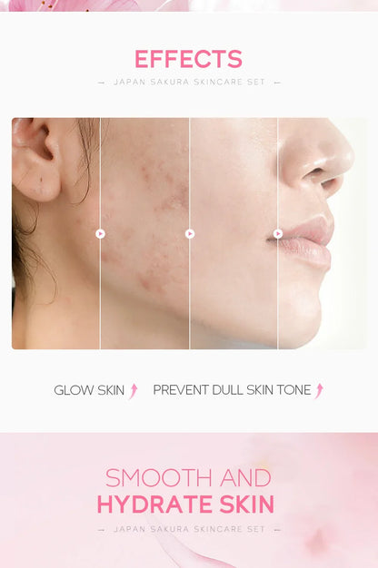 LAIKOU Sakura skincare set